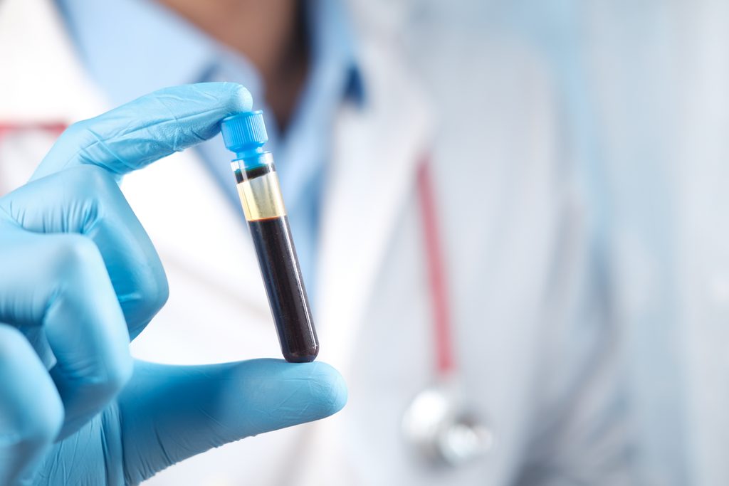 Medical professional wearing blue gloves holds glass vial tube of blood.